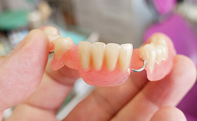 img-partial-denture